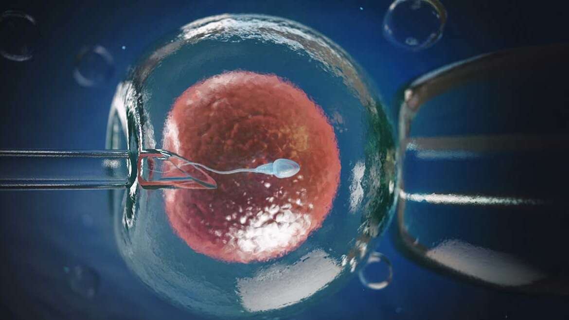 IVF (In Vitro Fertilisation) Method and Implementation