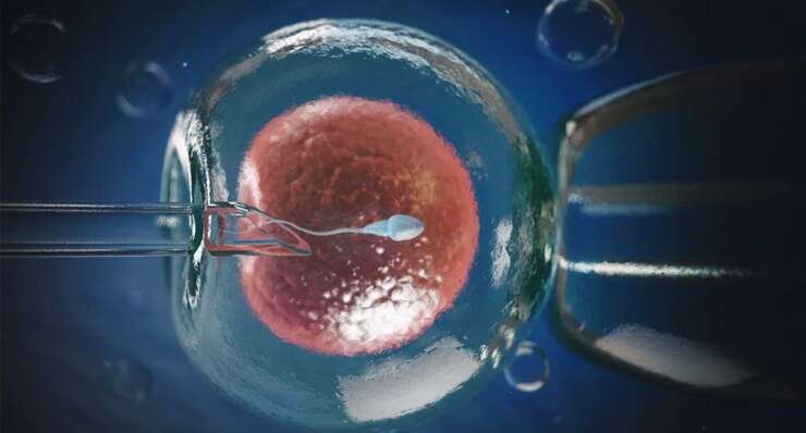 IVF (In Vitro Fertilisation) Method and Implementation