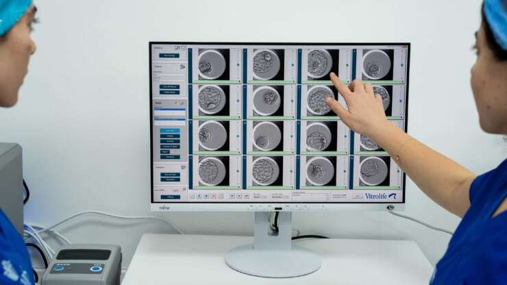 The first artificial intelligence-driven sperm selection in Cyprus