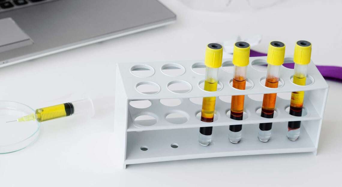 PRP (Trombositten Zengin Plazma)