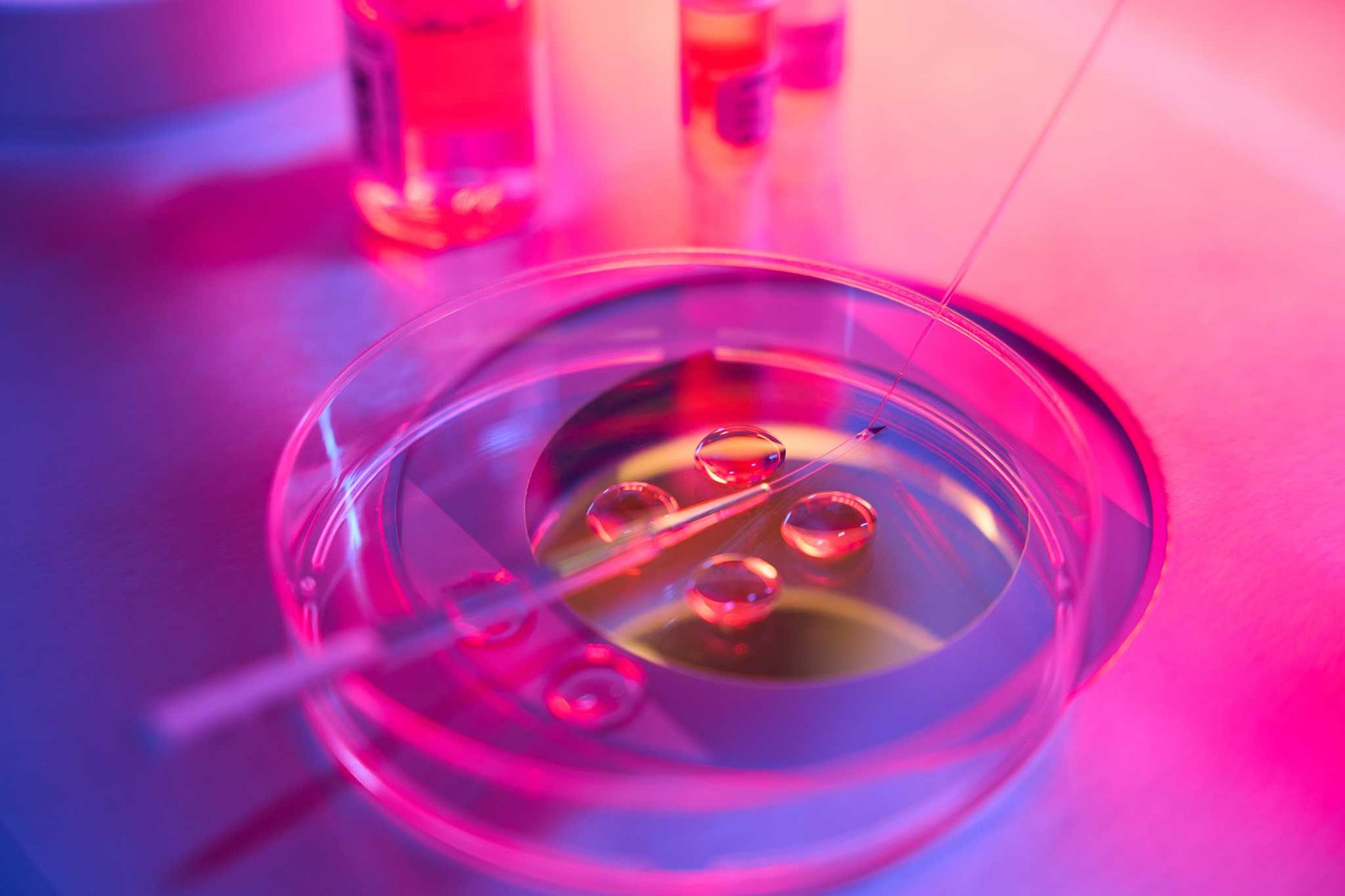 Ventus IVF embriyo biyopsisi ve gelişmiş laboratuvar uygulaması